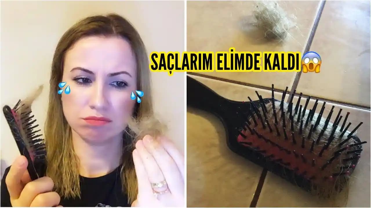 Saç Dökülmesine Karşı Doğal Maskeler ve Saç Sağlığını Koruma Yöntemleri