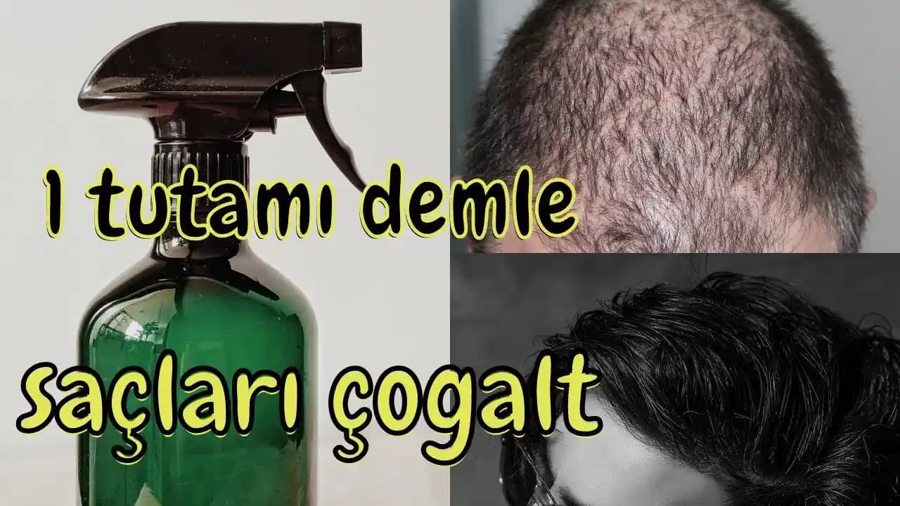 Saç Dökülmesine Karşı Doğal ve Bilimsel Yöntemler: Etkili Bakım Tavsiyeleri