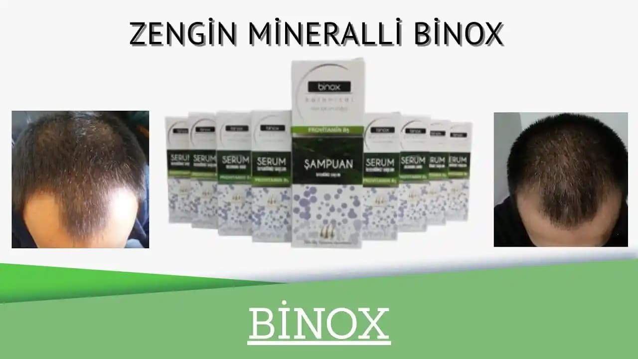 Saç Dökülmesine Karşı Etkili Şampuanlar ve Doğal Bakım Önerileri