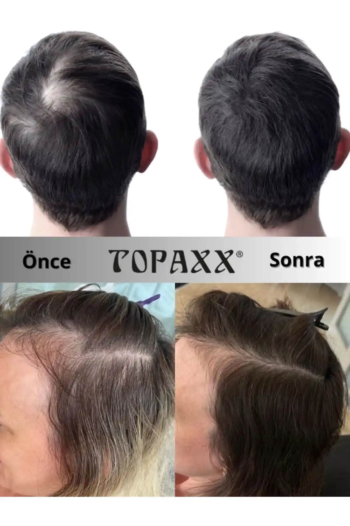 Saç Dolgunlaştırıcı Boyalar ve Ürünlerle Hacim Artışı Sağlayan Çözümler