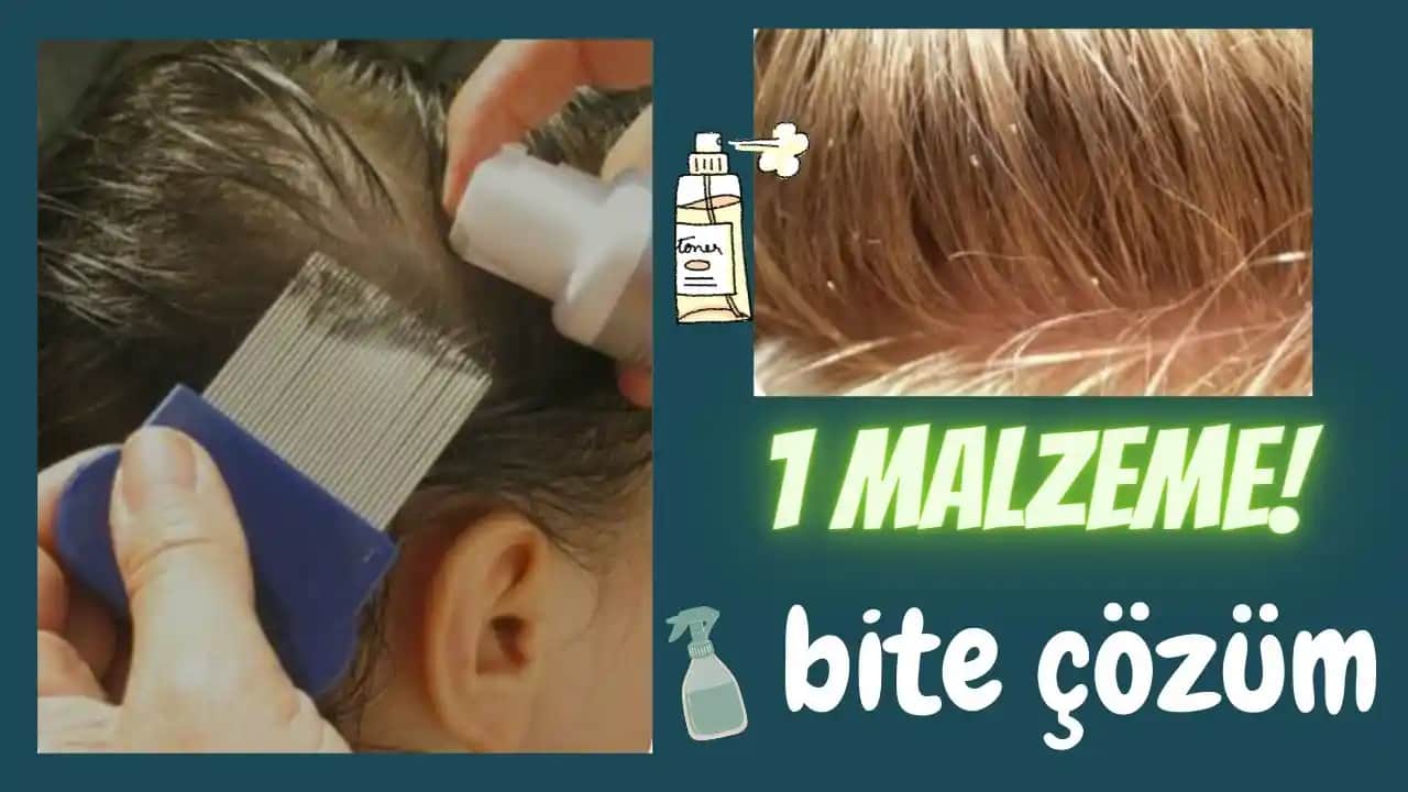Saç Kremi ile Bit Temizleme Yöntemleri: Doğal ve Etkili Çözümlerle Parazitlerle Mücadele