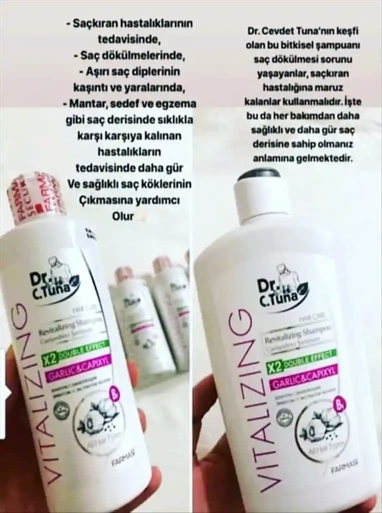 Saç Mantarı Tedavisinde Etkili Şampuanlar ve Doğal Çözümler Hakkında Bilgiler