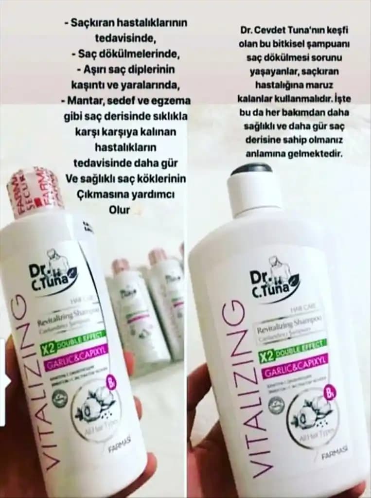 Saç Mantarı Tedavisinde Etkili Şampuanlar ve Doğal Çözümler Hakkında Bilgiler