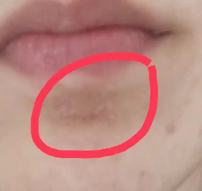 Kuru ve Pul Pul Dökülen Yüz Cildini Sağlıklı Tutmak İçin Etkili Bakım Yöntemleri