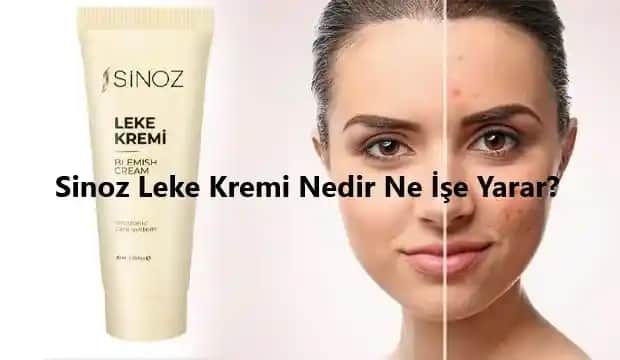 Sinoz Leke Kremi Kullanımı ve Etkili Cilt Lekesi Tedavi Yöntemleri