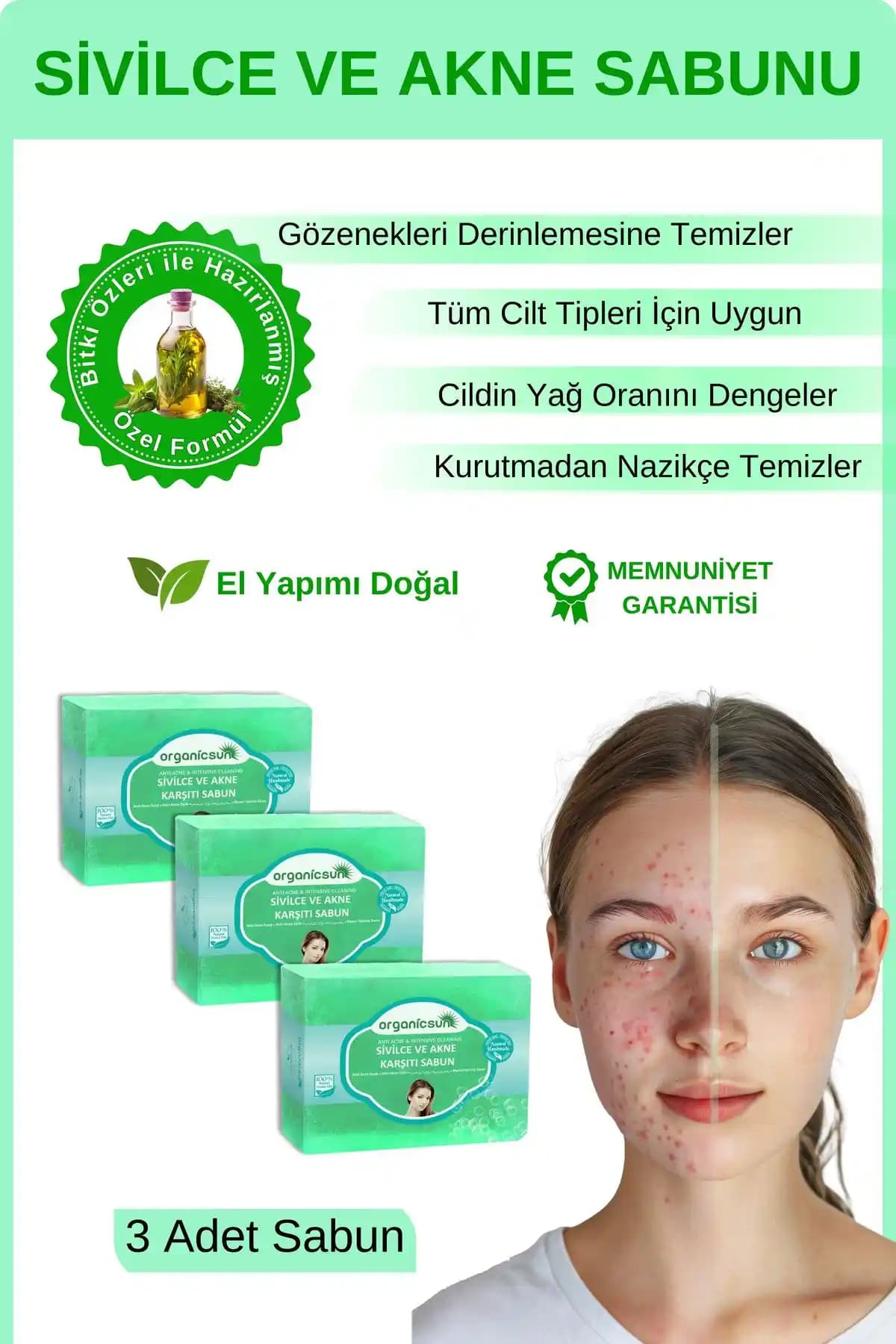 Sivilce Karşıtı Sabunlar: En Etkili Ürünler ve Kullanım Tavsiyeleri