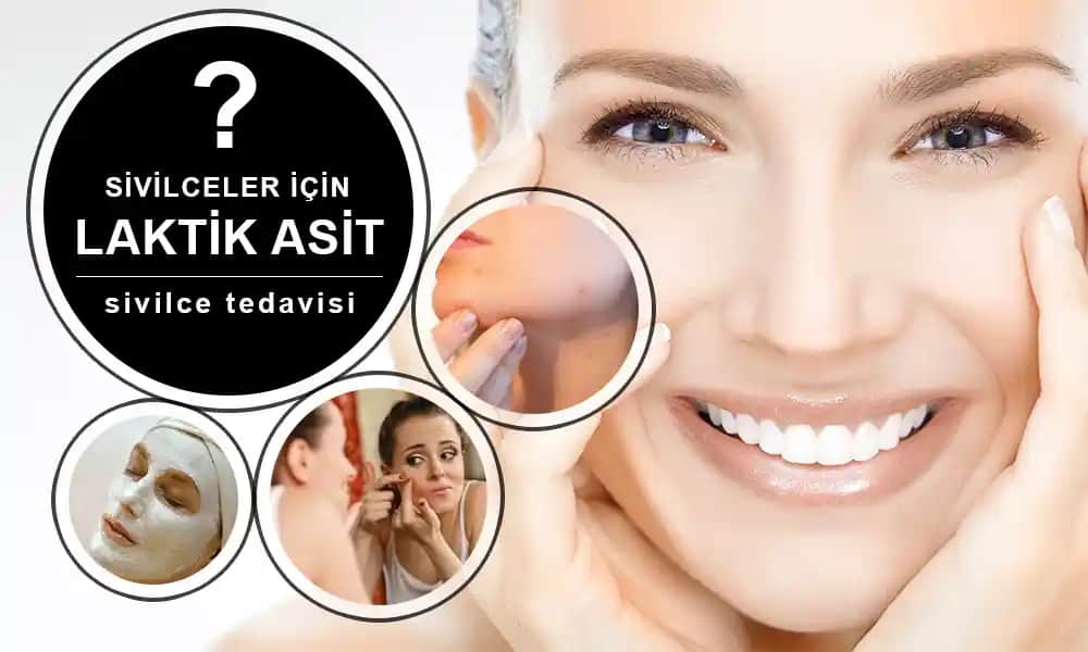 Sivilce ve Akne Sorunlarında Asit Kullanımı: Güvenli ve Etkili Çözümler