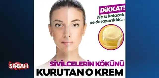 Sivilceyi Hızla Kurutan En Etkili Kremler ve Doğal Yöntemler Rehberi