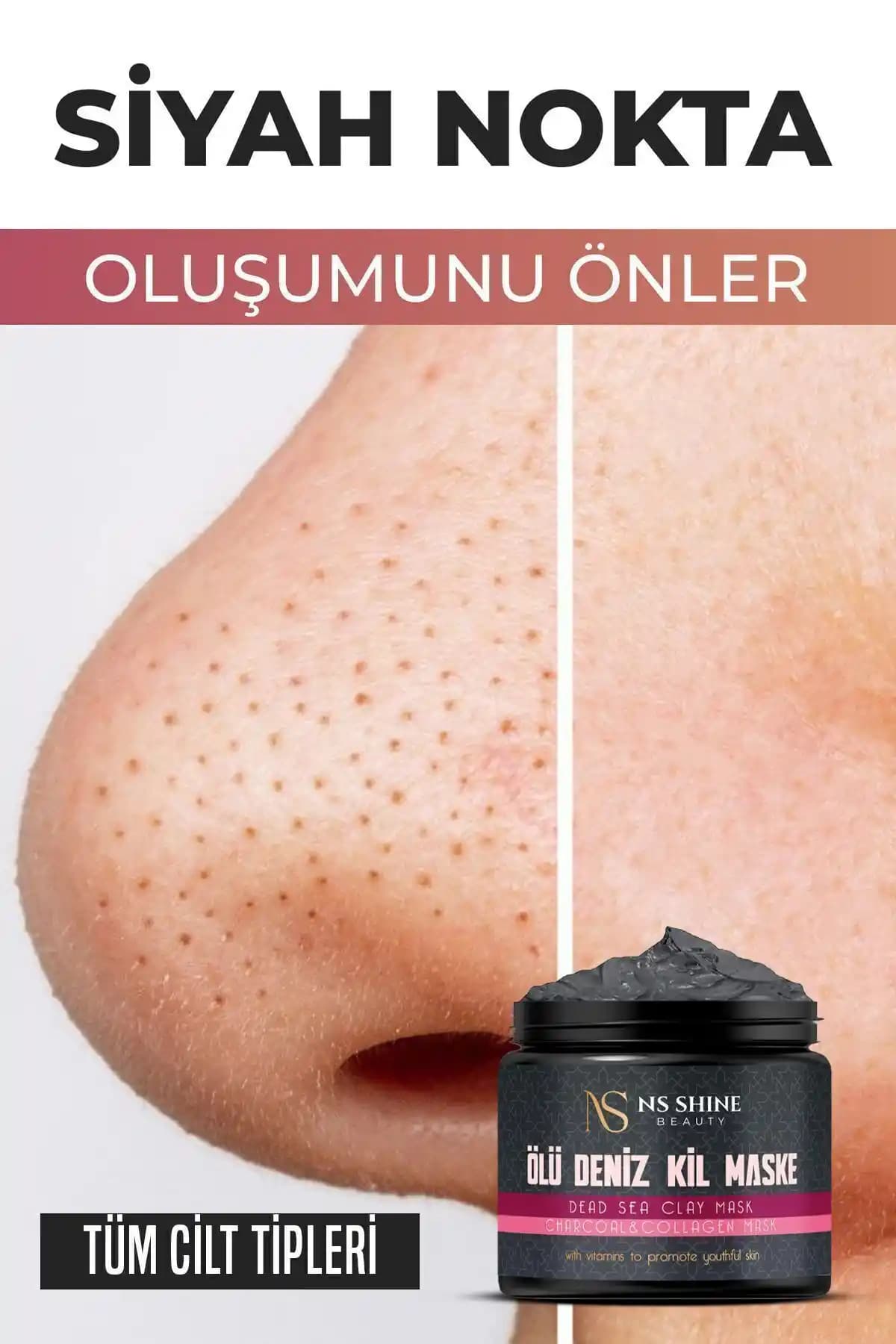 Siyah Nokta Giderici Yöntemler ve Doğal Çözüm Tavsiyeleri