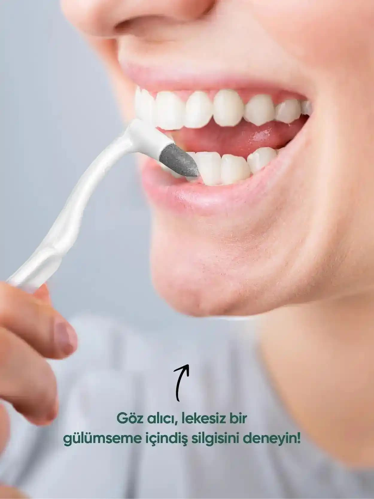 2025'te T-Brush Diş Silgisi ile Gülüşünüzü Baştan Yaratın