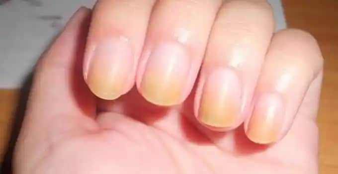 Tırnak Bakımı ve Güzellik İşlemleri: Sağlık ve Estetik Açısından Bilmeniz Gerekenler