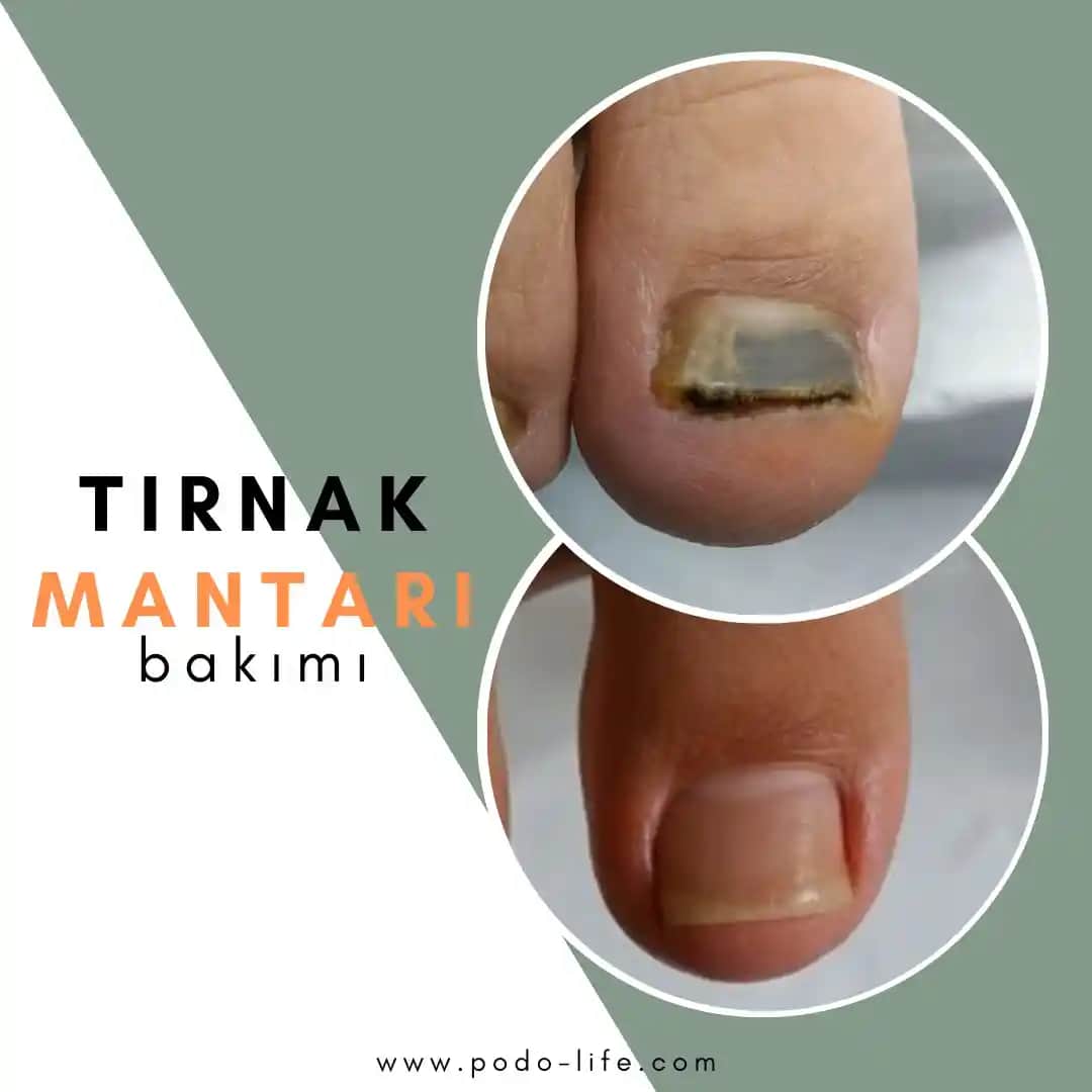 Tırnak Güçlendirme Yöntemleri ve En Etkili Ürünler Hakkında Kapsamlı Bilgi