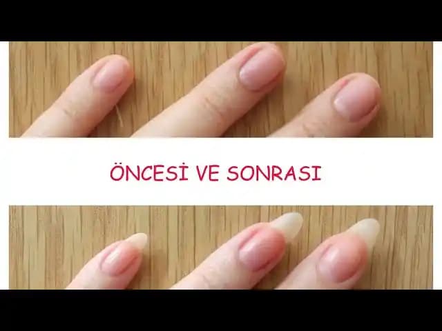 Tırnak Uzatan Vitaminler ve Doğal Yöntemlerle Güçlü Tırnaklar İçin Kapsamlı Rehber