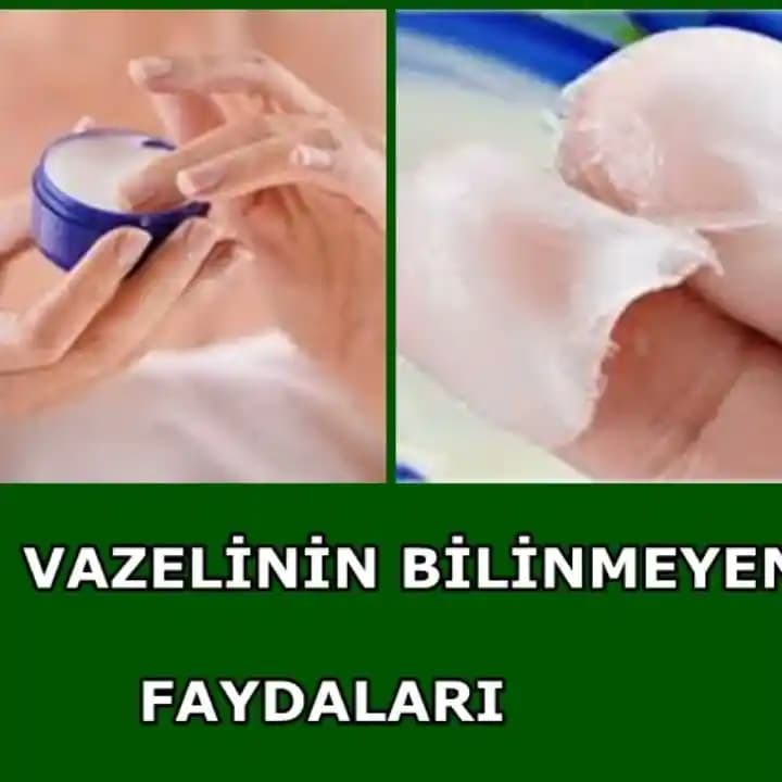 Vazelin Nedir, Faydaları ve Kullanım Alanları Hakkında Detaylı Bilgi