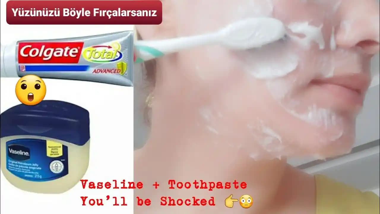 Vazelin ve Diş Macunu Karışımının Cilt Bakımında Kullanımı ve Potansiyel Riskleri