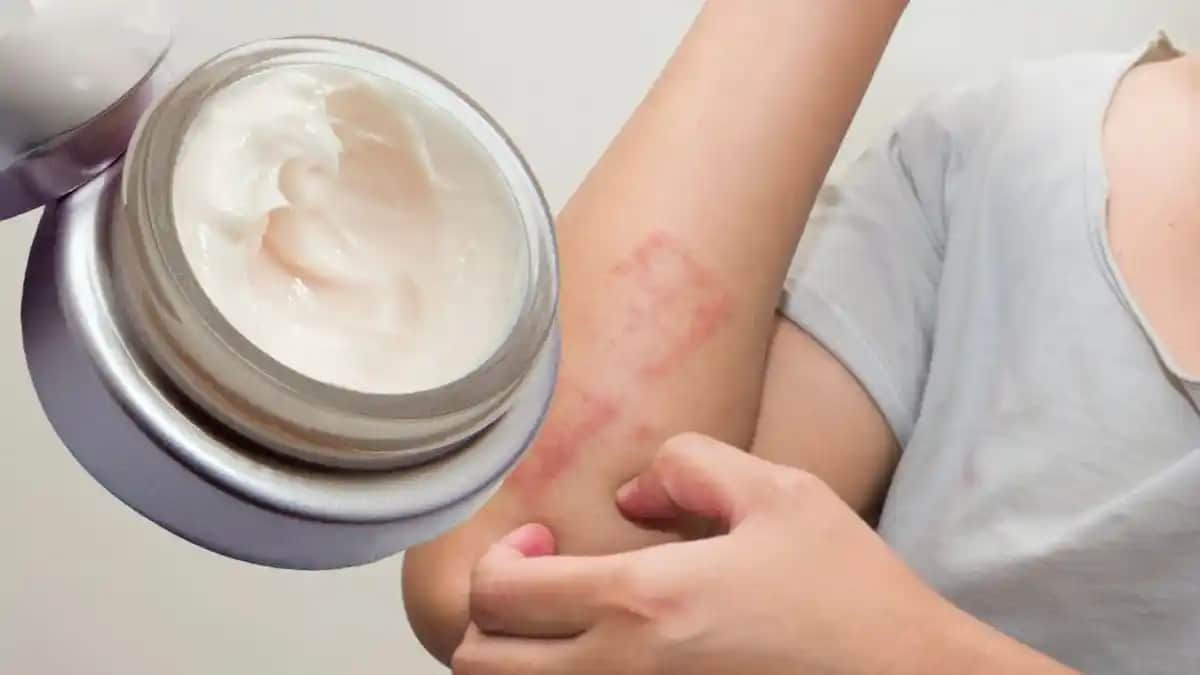 Vücut Kaşıntısına Karşı En Etkili Kremler ve Doğru Kullanım Yöntemleri