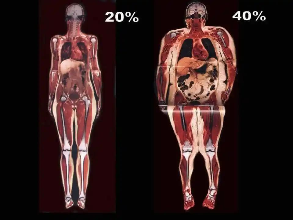 Vücut Yağlarının Çeşitleri ve Cilt Sağlığına Etkileri Üzerine Kapsamlı Bilgi