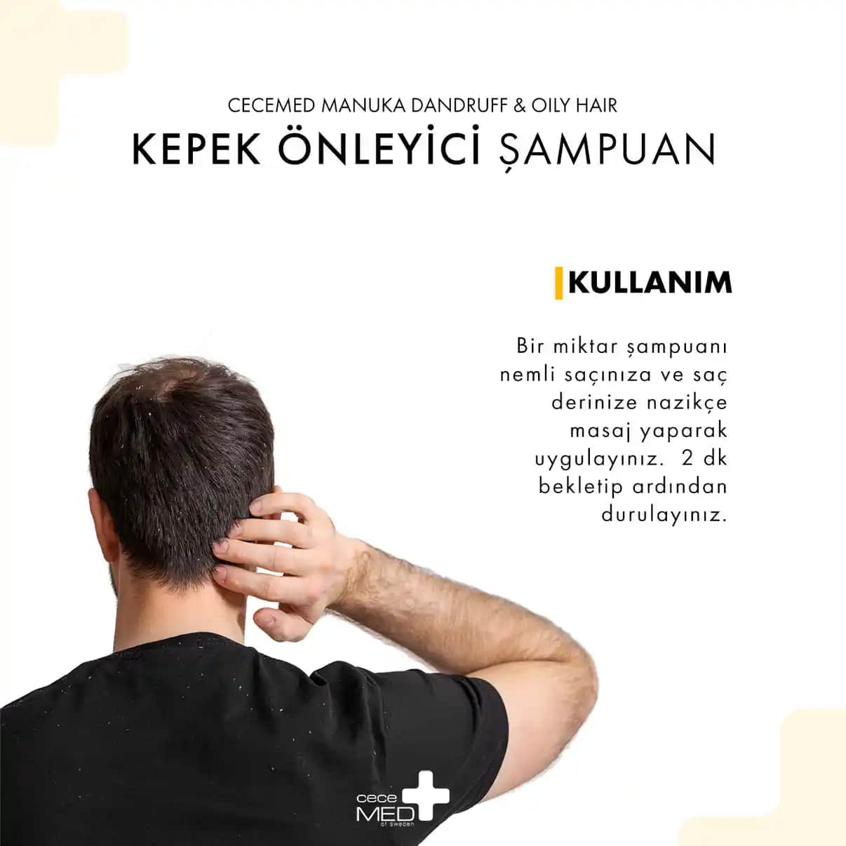 Yağlı Kepek Nedenleri Belirtileri ve Etkili Çözüm Yolları Hakkında Kapsamlı Bilgi