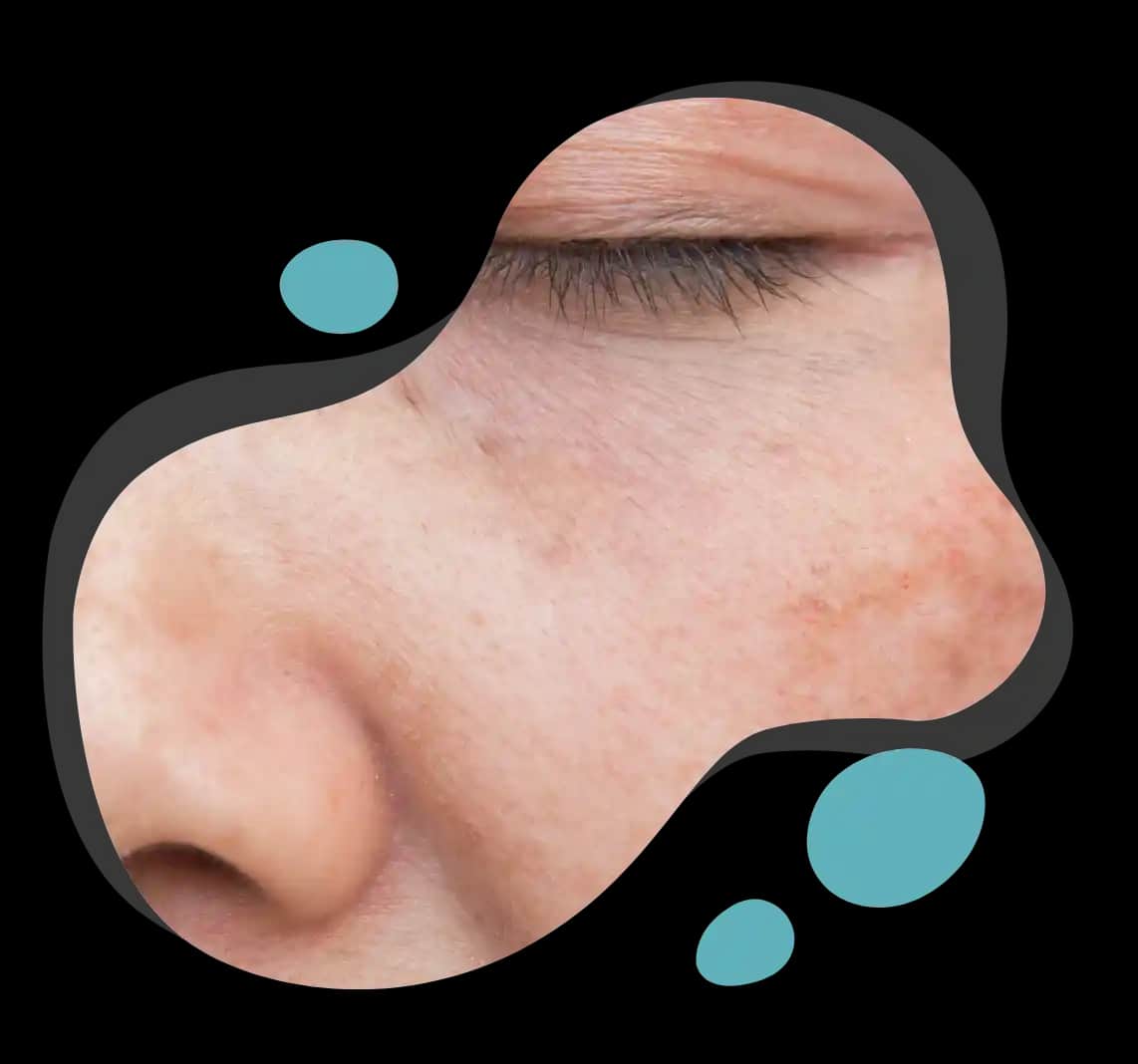 Yıpranmış Ciltlere Karşı Etkili Kozmetik Çözümler ve Bakım Önerileri