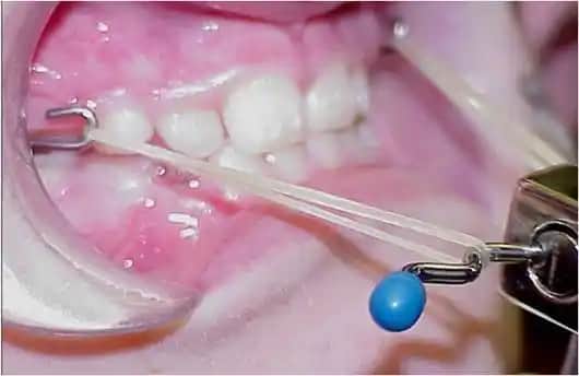 Yüz Maskeleri ve Diş Bakımı: Kozmetikte Güncel Trendler ve Yenilikler