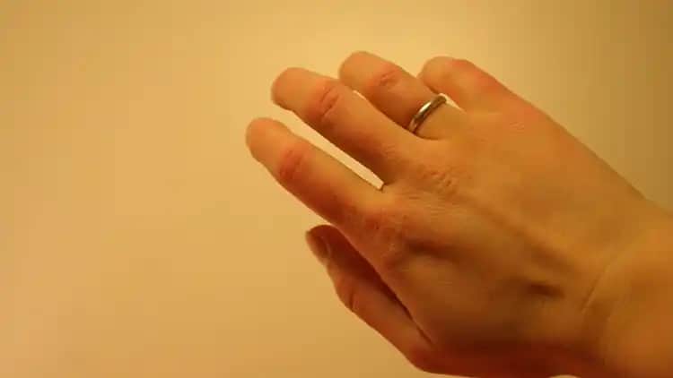 Yüzde Kuruluk Nedenleri Belirtileri ve Etkili Çözüm Yolları Hakkında Kapsamlı Bilgi