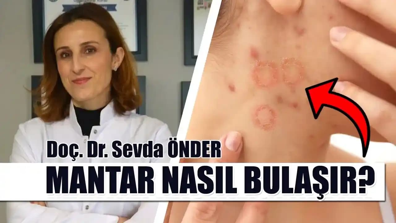 Yüzde Mantar Enfeksiyonları: Belirtileri, Tedavi Yöntemleri ve Korunma İpuçları