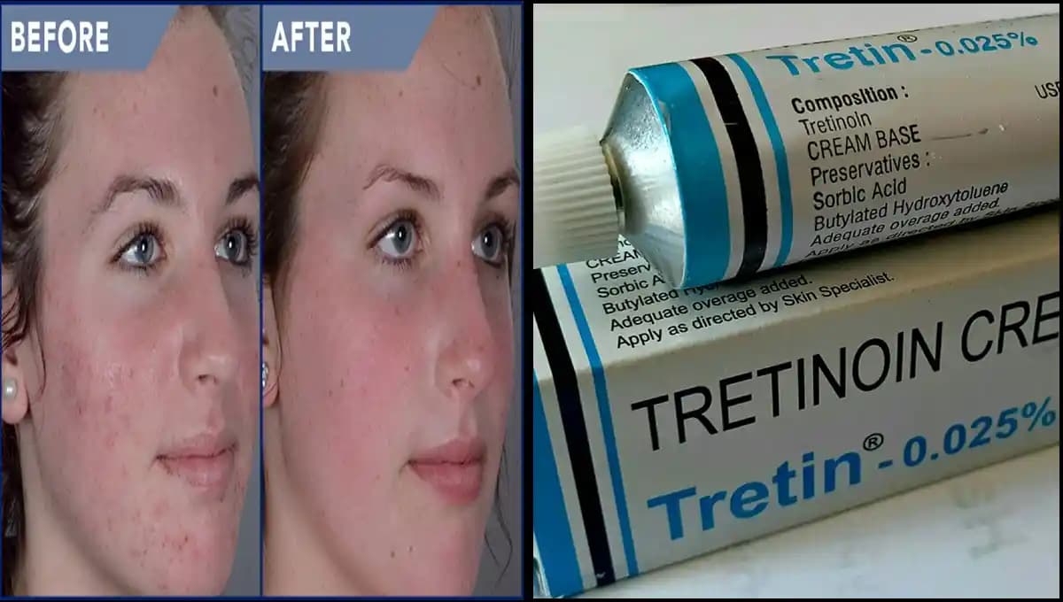 Yüzdeki Kırışıklıklar İçin En Etkili Kremler ve Bakım İpuçları