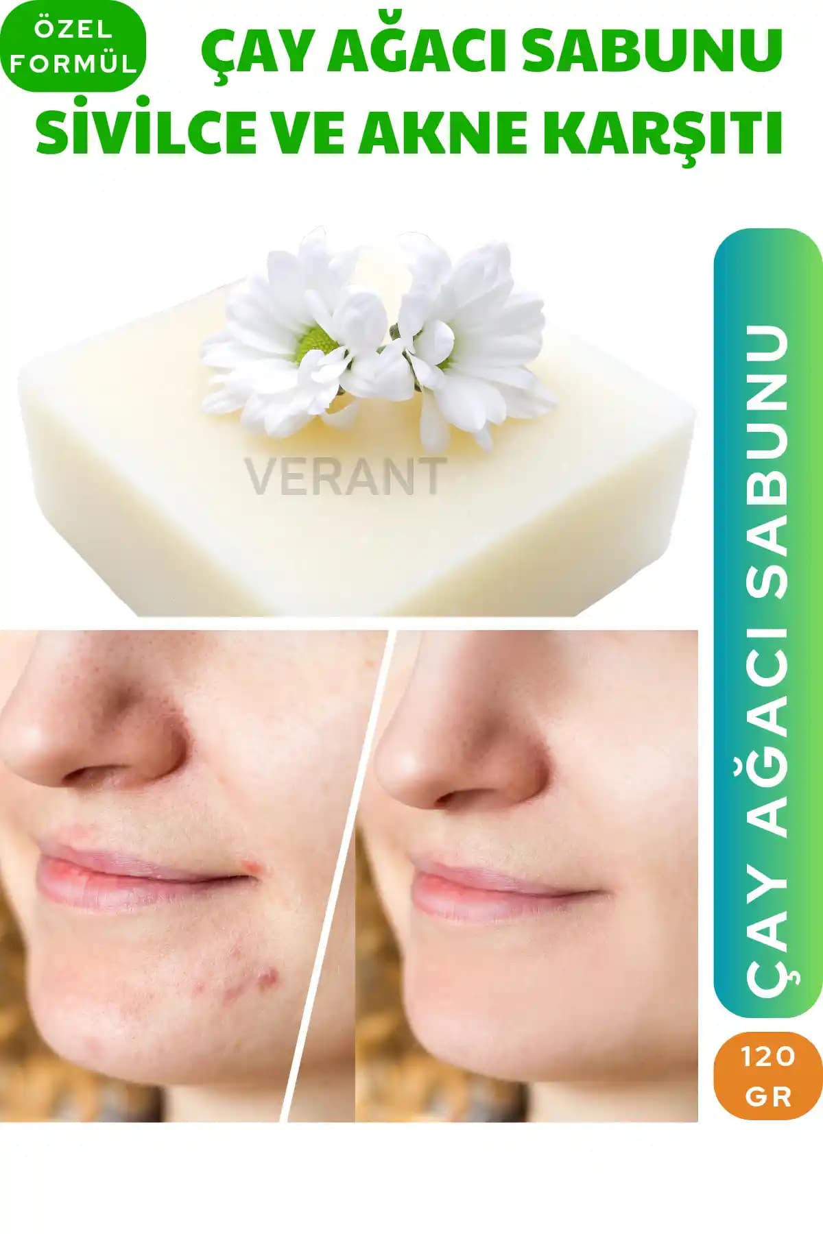VERANT Çay Ağacı Sabunu 120 gr: Doğal ve Etkili Akneye Karşı Cilt Bakımı