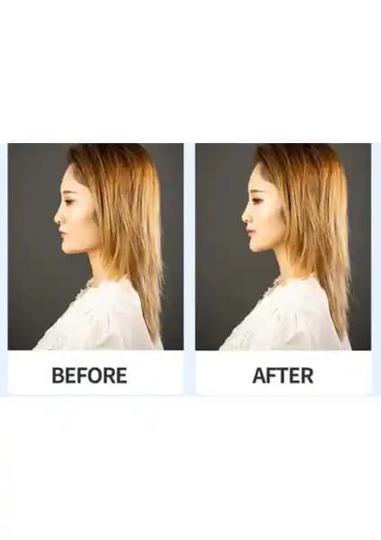 Lasting Beauty Kaş ve Göz Germe Yüz Gerdirme İpli Toka Çekik Göz Estetik Çözüm