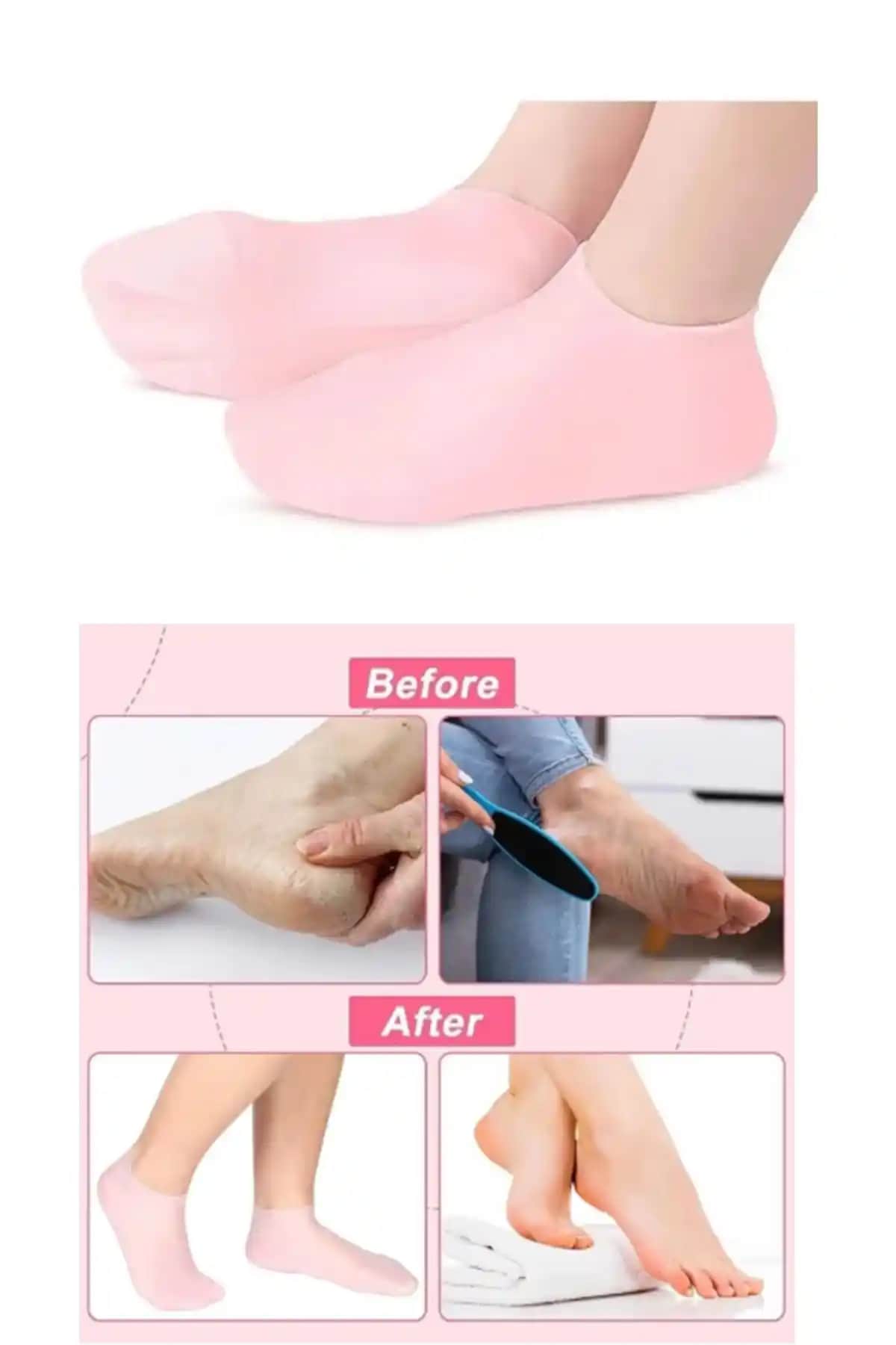 İndirimKap Silikon Nemlendirici ve Jigott Miracle Ayak Maskesi Karşılaştırması