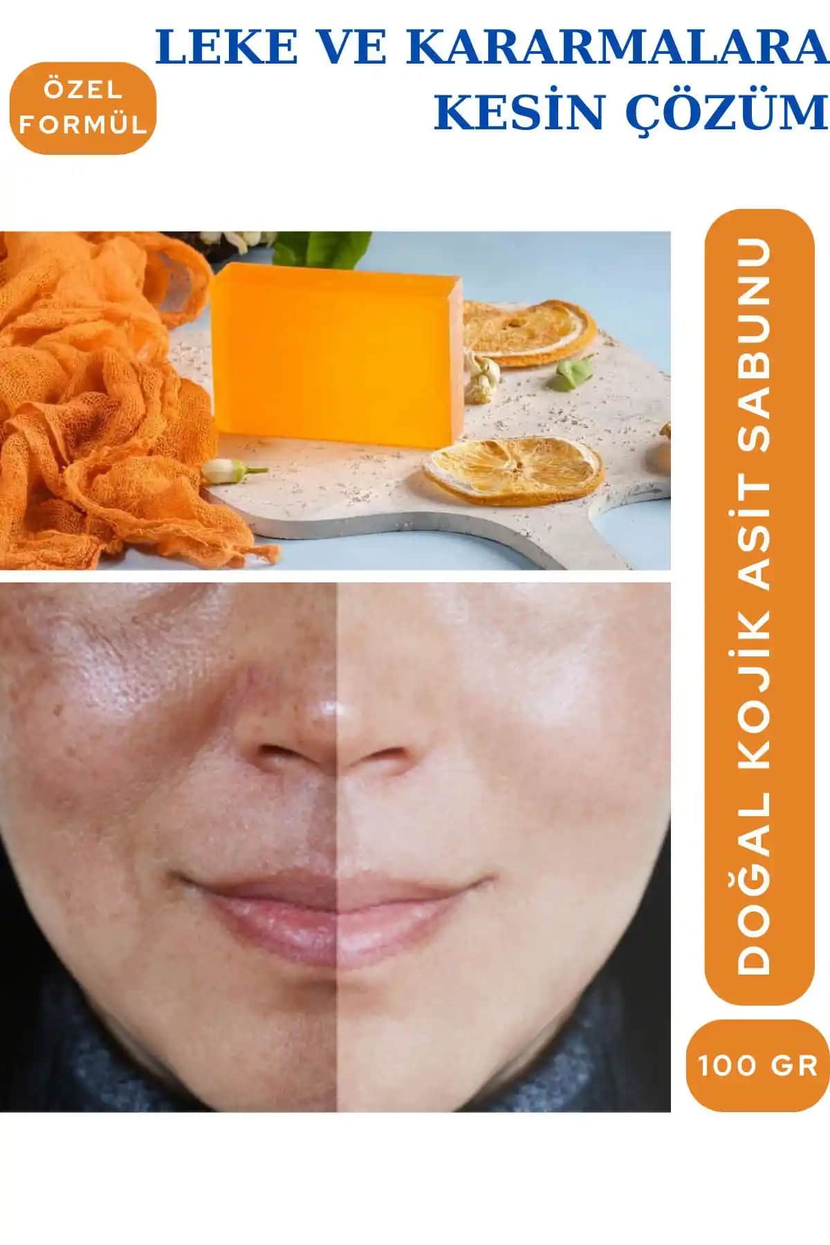 VERANT Kojic Asit Sabunu: Doğal ve Etkili Leke Karşıtı Cilt Temizleme Ürünü