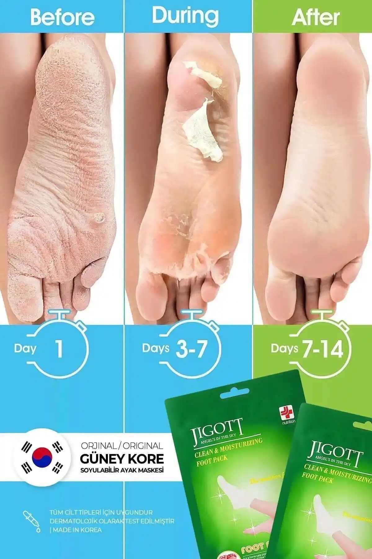 Jigott ve Mara Ayak Peeling Maskeleri Karşılaştırması: Hangi Ürün Daha Etkili