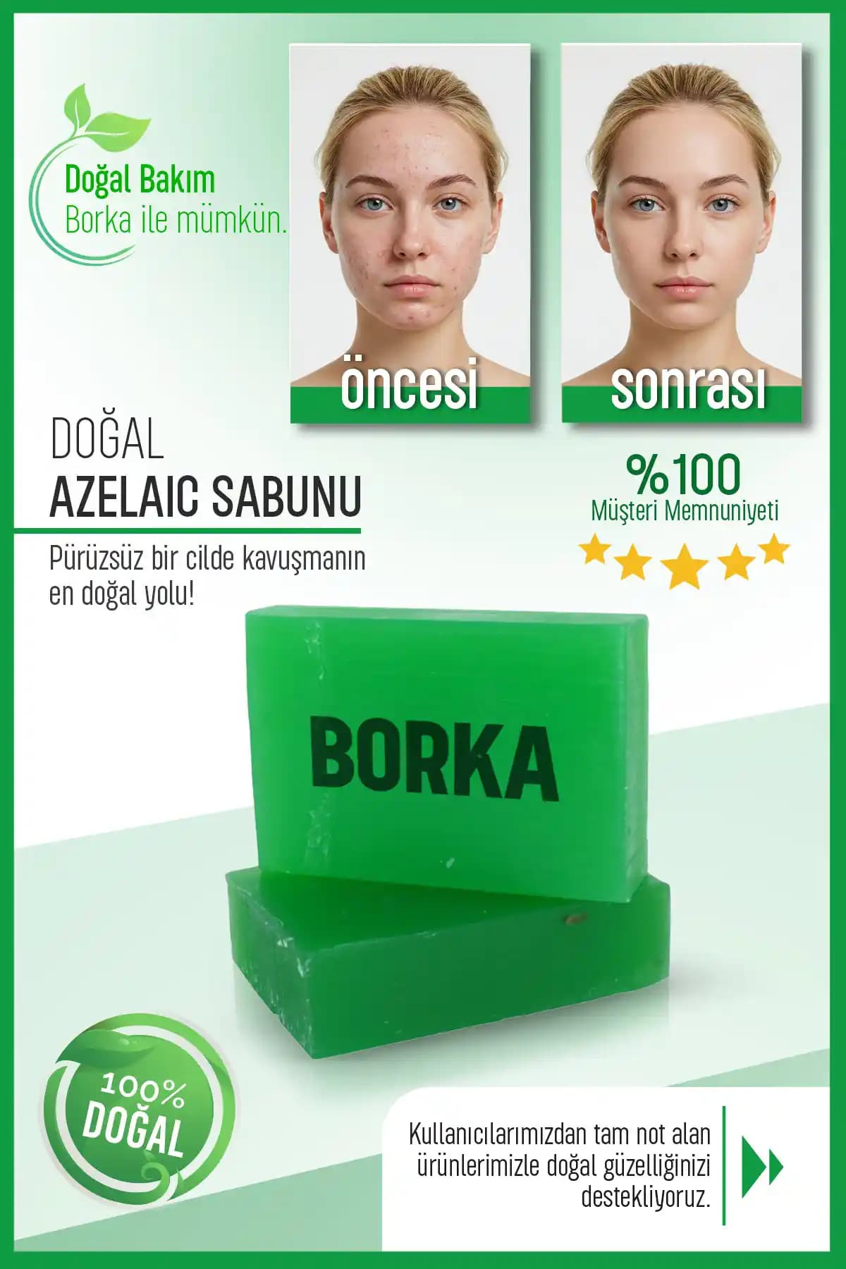 BORKA Azelaic Yüz Temizleme Barı: Derinlemesine Temizlik ve Gözenek Sıkılaştırıcı Özellikler