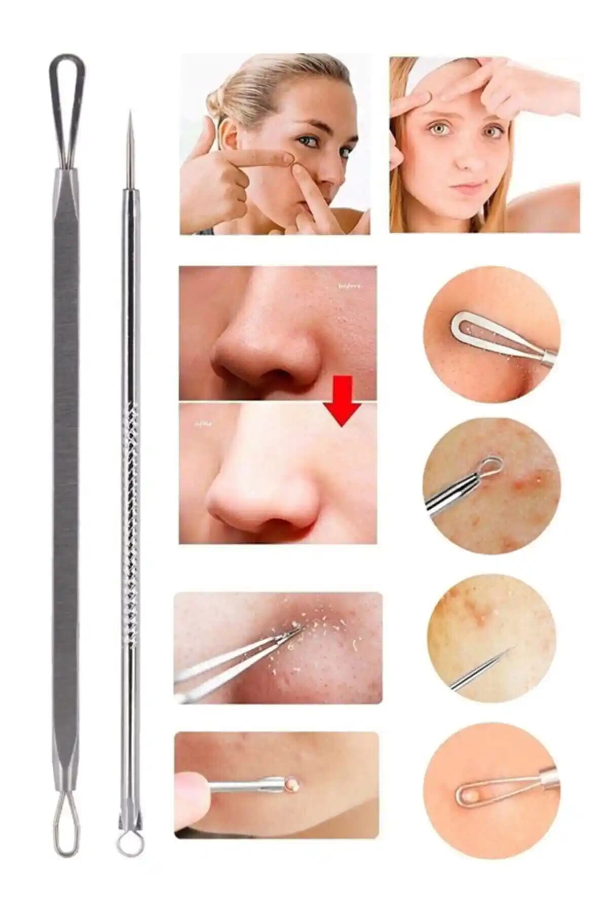 Çiftli Akne ve Siyah Nokta Temizleyici Çelik Seti ile Cilt Bakımında Etkili Çözüm