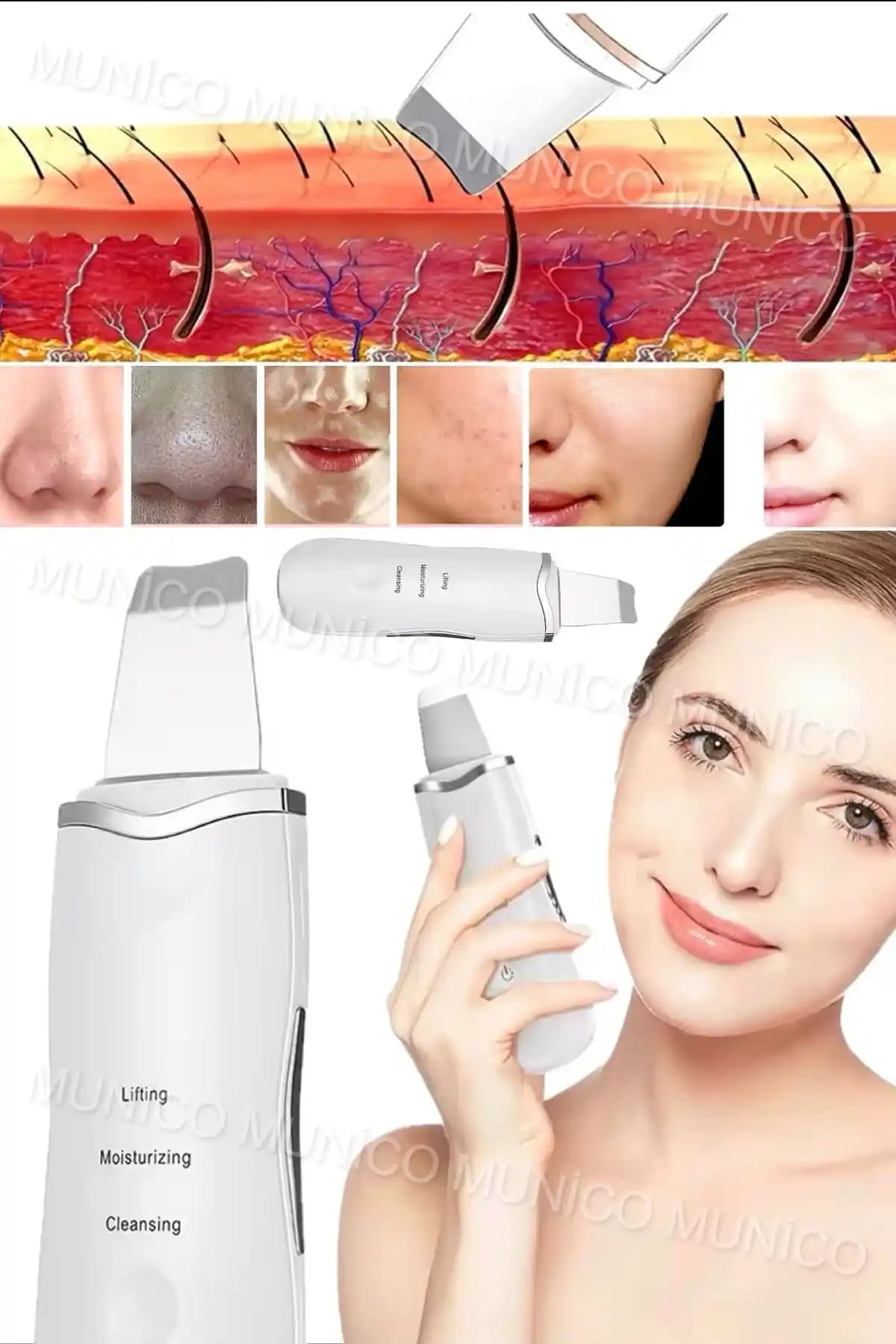 Ultrasonik Yüz Temizleyici Cihazı: Derinlemesine Temizlik ve Akne Giderme Özellikleri