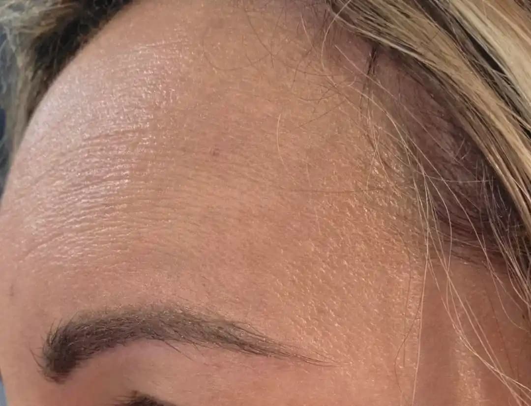 Ciltte İnce Çizgiler ve Kuruluk: Nedenleri, Bakım Yöntemleri ve Tedavi Seçenekleri