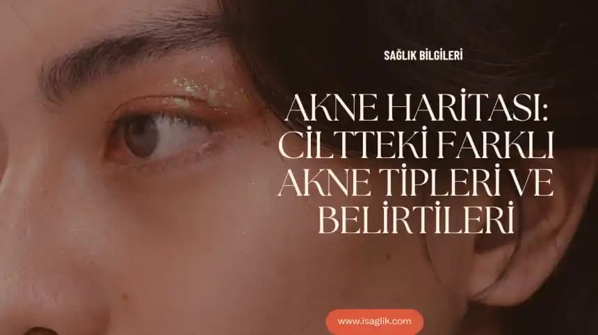 Çocukların Akne Hakkındaki Doğrudan Yorumları ve Psikolojik Etkileri Üzerine Analiz