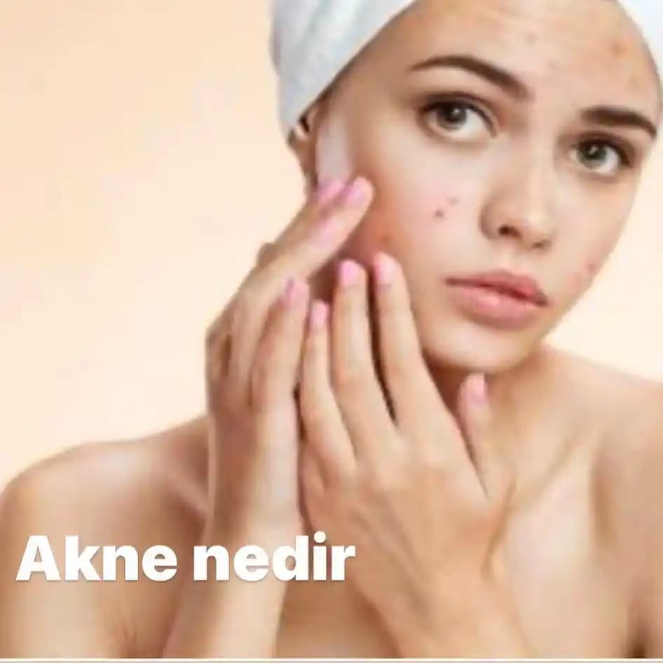 Randevu Sonrası Akneyle İlgili Kaba Yorumların Psikolojik Etkileri ve İlişkilerde Saygının Önemi