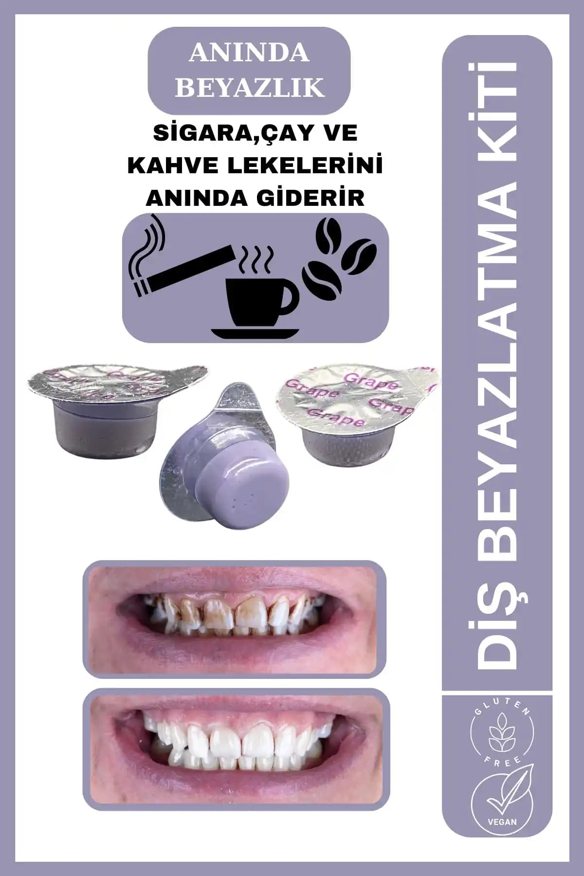 AVANT DENTAL SUPPLY Üç Tüplü Üzüm Aromalı Diş Beyazlatıcı Seti İncelemesi