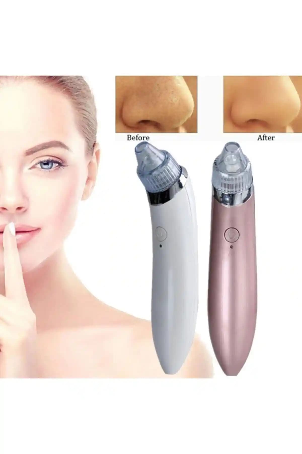 Satfinder Vakumlu Siyah Nokta Akne Temizleme Cihazı ile Derinlemesine Cilt Bakımı ve Gözenek Temizliği