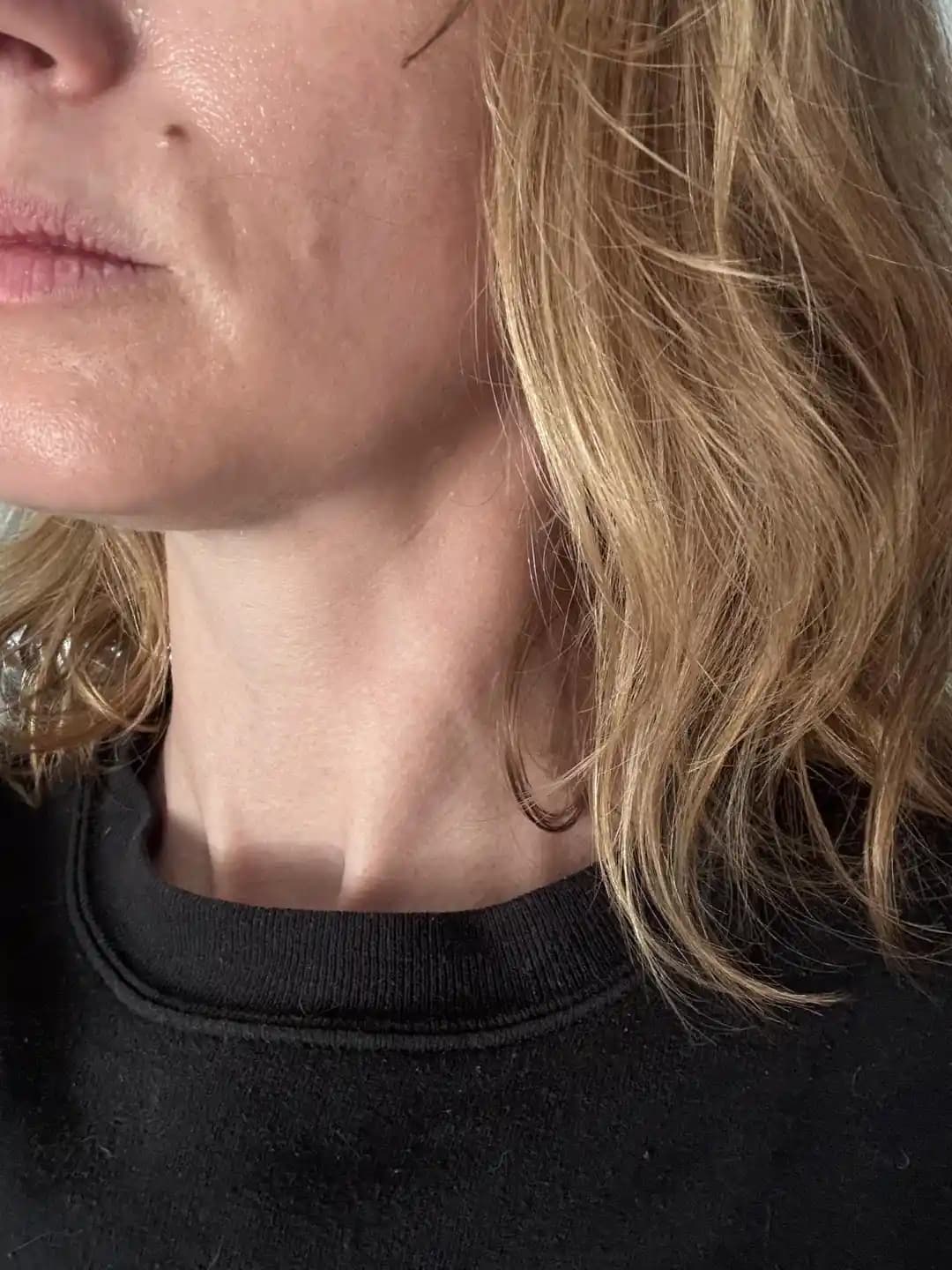 Ani Kilo Kaybı ve Uyku Problemlerinin Cilt Sağlığına Etkileri ve Çözüm Yöntemleri