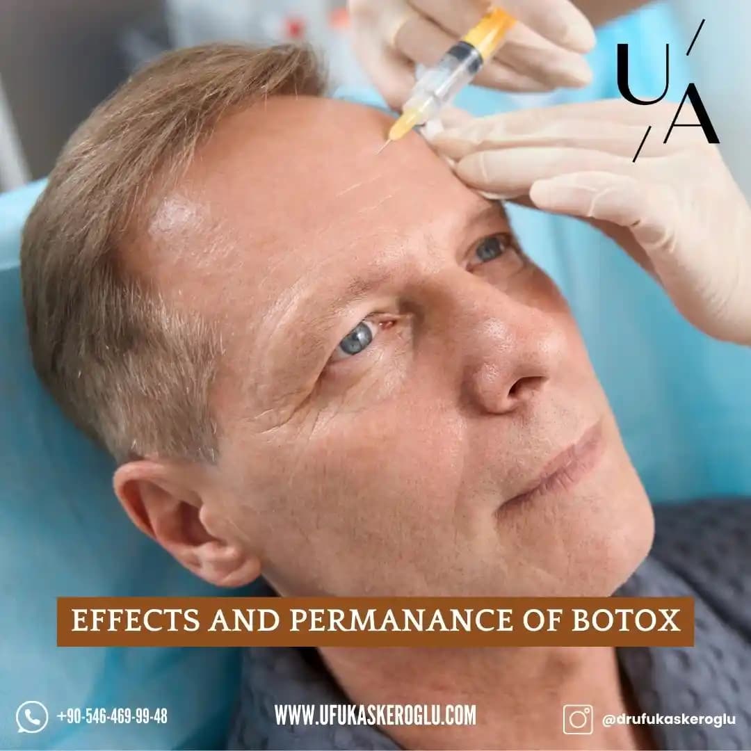 Botoksun Uzun Vadeli Etkileri: Klinik Bulgular ve Kullanıcı Deneyimleri Üzerine Analiz