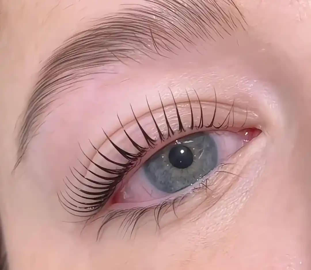 Kirpik Liftingi Nedir, Sonrası Nasıl Görünür ve Bakımı Nasıl Yapılır?