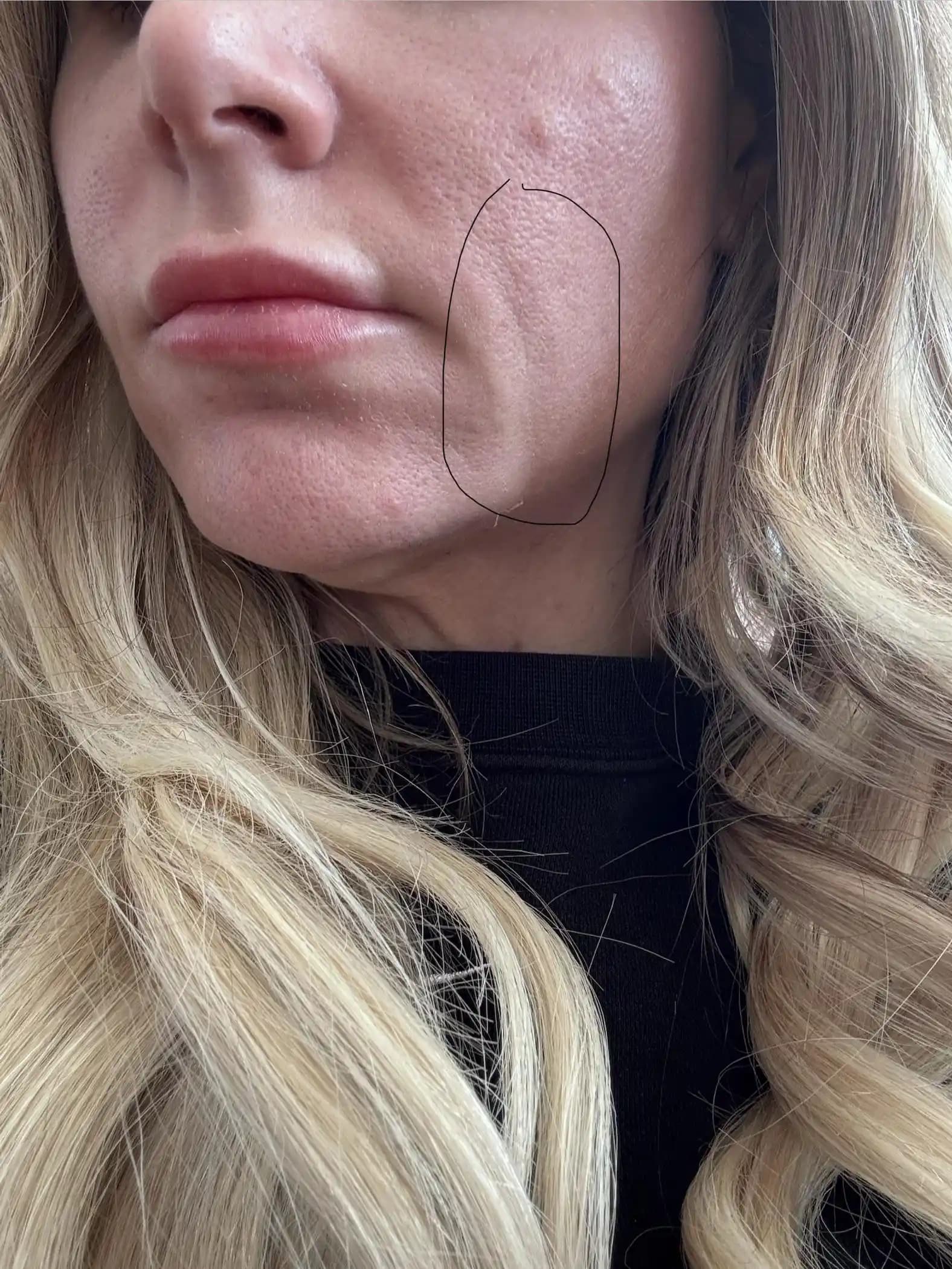 Yüzde İnce Çizgiler ve Sarkmaları Azaltmak İçin Etkili Tedavi Yöntemleri ve Bakım Önerileri