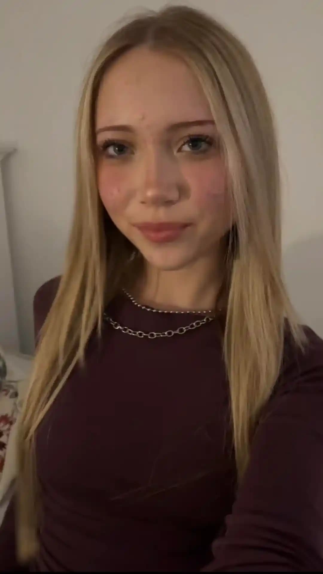 Sivilcenin Yüz Estetiği ve Psikolojik Etkileri: Gerçekler ve Tedavi Yöntemleri