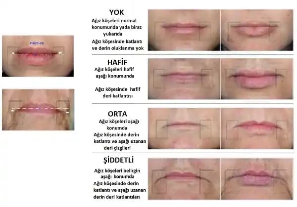 Ağız Köşelerindeki Gölgelere Yönelik Etkili Bakım ve Müdahale Yöntemleri