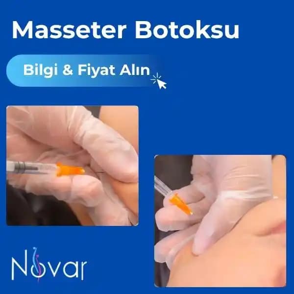 Masseter Botox Uygulamasının Etki Süresi ve Yüz Şeklinin Geri Dönüş Süreci Hakkında Bilgiler