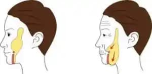 Perioral Mounds: Dudak Altındaki Gölge ve Çöküntülerin Anatomisi ve Nedenleri Hakkında Bilgi
