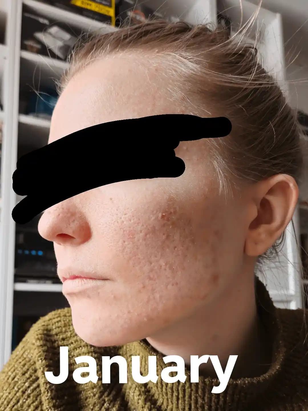 Yavaş İlerlemenin Cilt Bakımındaki Önemi ve Etkili Sabah-Akşam Rutinleri