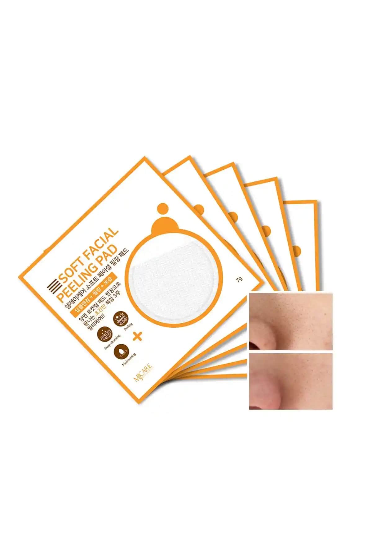 Mjcare Face Peeling 5'li Cilt Temizliği ve Yenileme İçin Güvenilir Çözüm